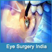 Best Cataract Surgery in India
