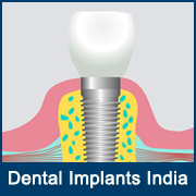 Best Dental Surgery Hospitals in India